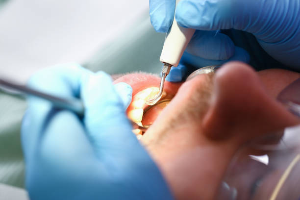 Best Emergency Gum Treatment in Emory, TX